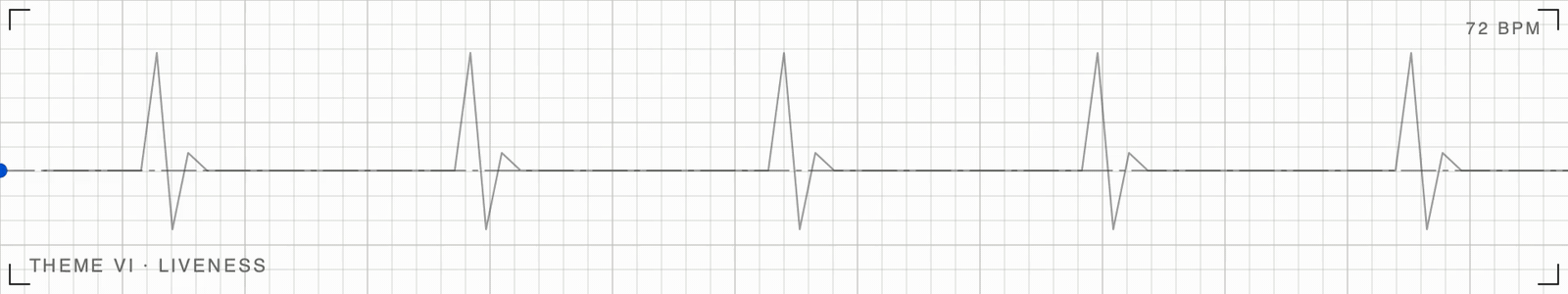 A heartbeat trace on graph paper